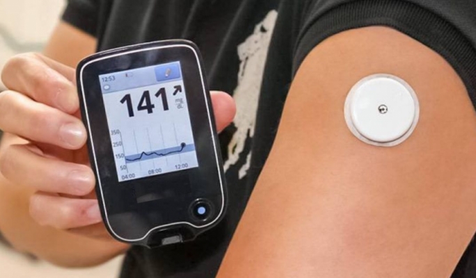 Free Continuous Glucose Monitoring service to be extended to 23-year-olds